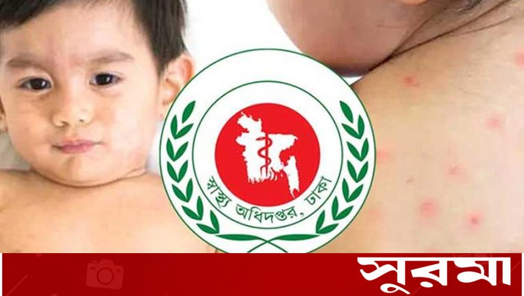 হাম উপসর্গে একদিনে ৯ শিশুর মৃত্যু, আক্রান্ত ১৩৪১